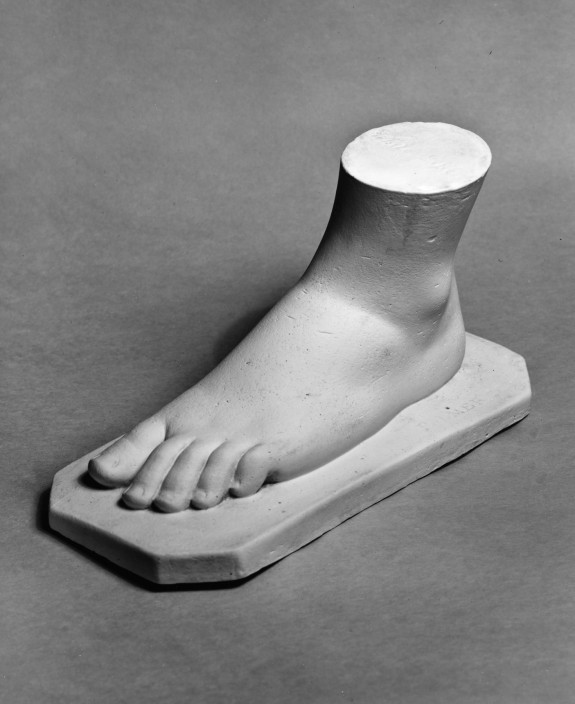 Cast of Foot of White Captive