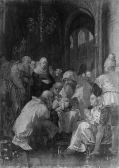Circumcision