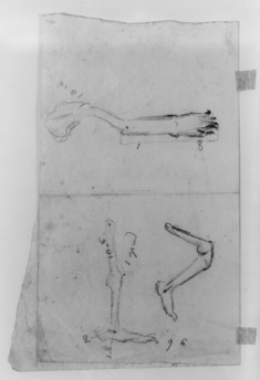 Image for Sketches of bones in man's leg (a)