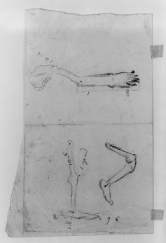 Sketches of bones in man's leg (a)
