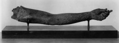 Left Arm