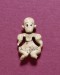 Thumbnail: Female Figure, Possibly with Dwarfism