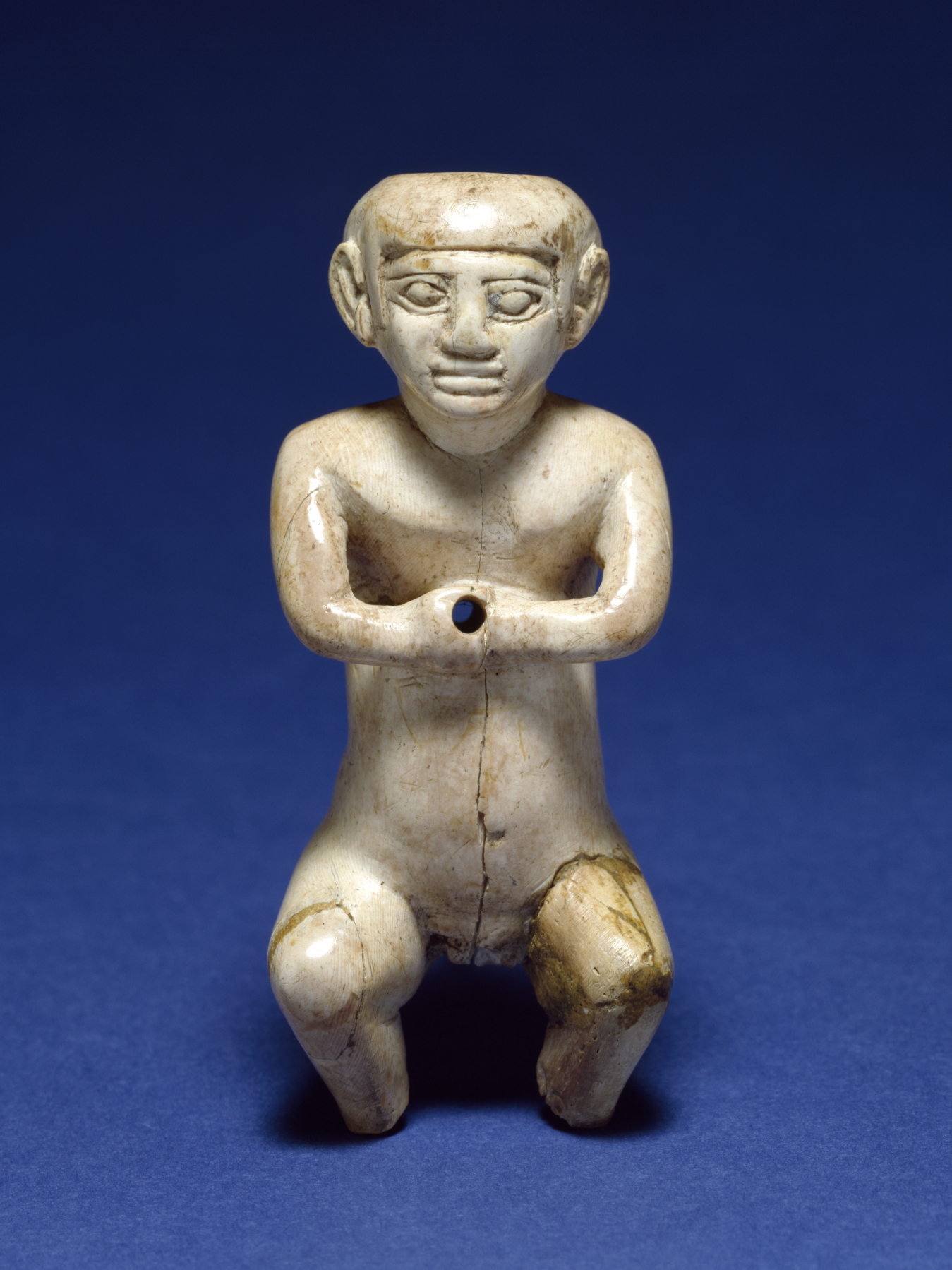 Male Figure, Possibly with Dwarfism