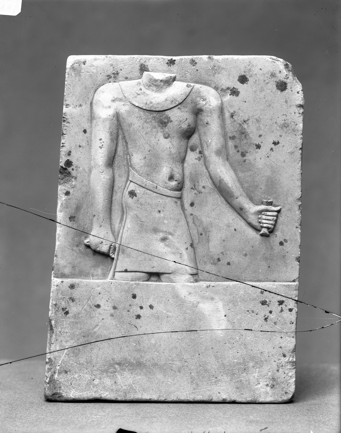 Model with a Male Torso and a Hand and Foot